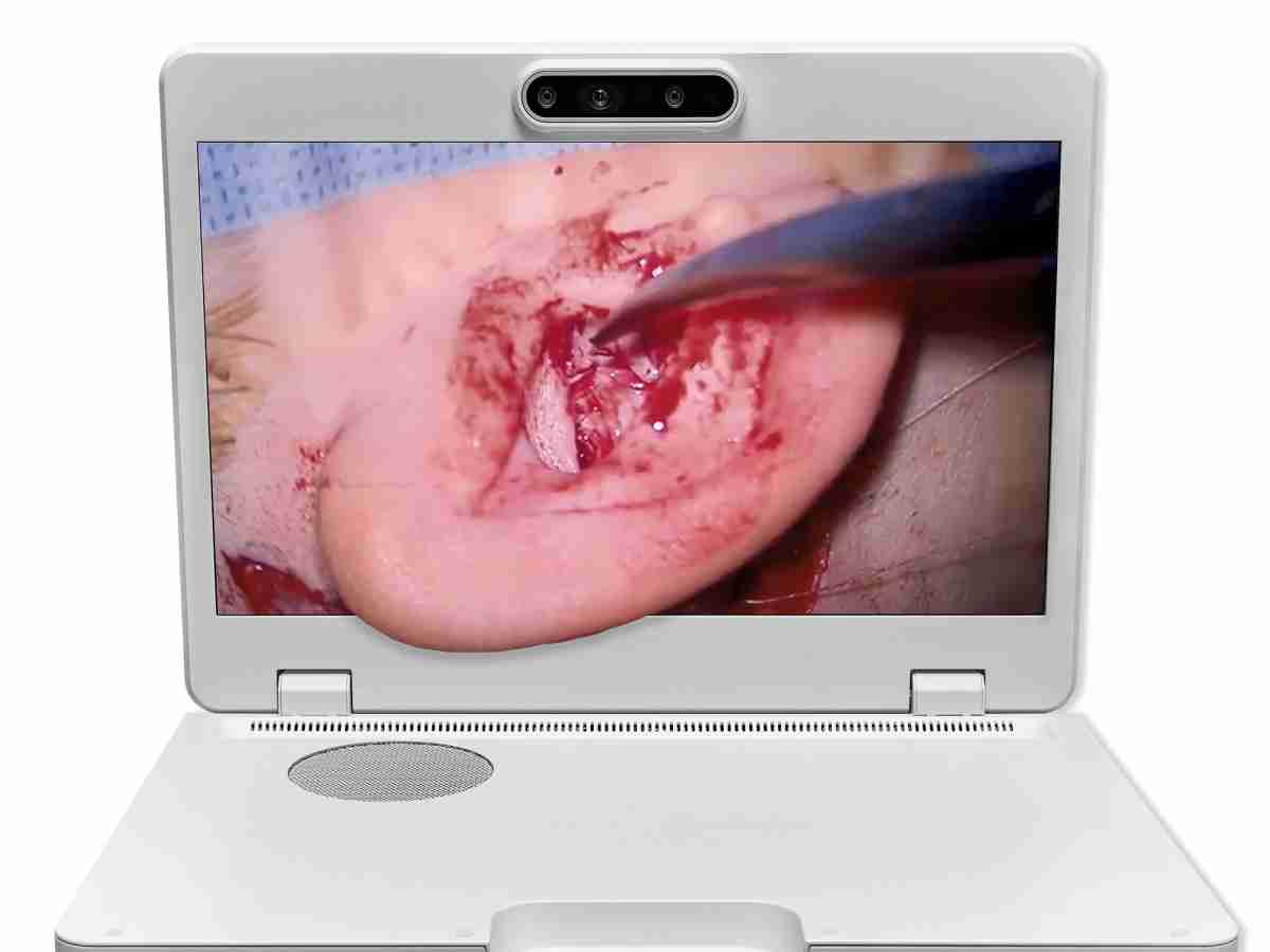 达擎之＂Heads-up 3D显微手术显示系统＂，，，，整合4K裸眼3D显示及眼球追踪系统，，，具备快速追踪人眼移动位置功能，，，，减轻医师长时间维持固定姿势的负担，，，，让医师能有更宽广清晰的3D立体视野及更舒适的姿势来执行手术。。。。